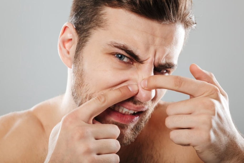 Homme avec points noirs sur le nez