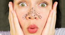 Femme avec des points noir sur le visage 