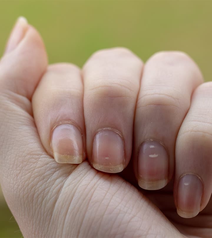 ongles d'une main 